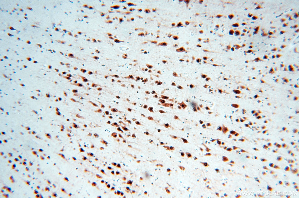 Immunohistochemistry (IHC) staining of human brain tissue using ELAVL2 Polyclonal antibody (14008-1-AP)