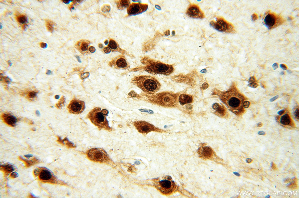 Immunohistochemistry (IHC) staining of human brain tissue using ELAVL2 Polyclonal antibody (14008-1-AP)
