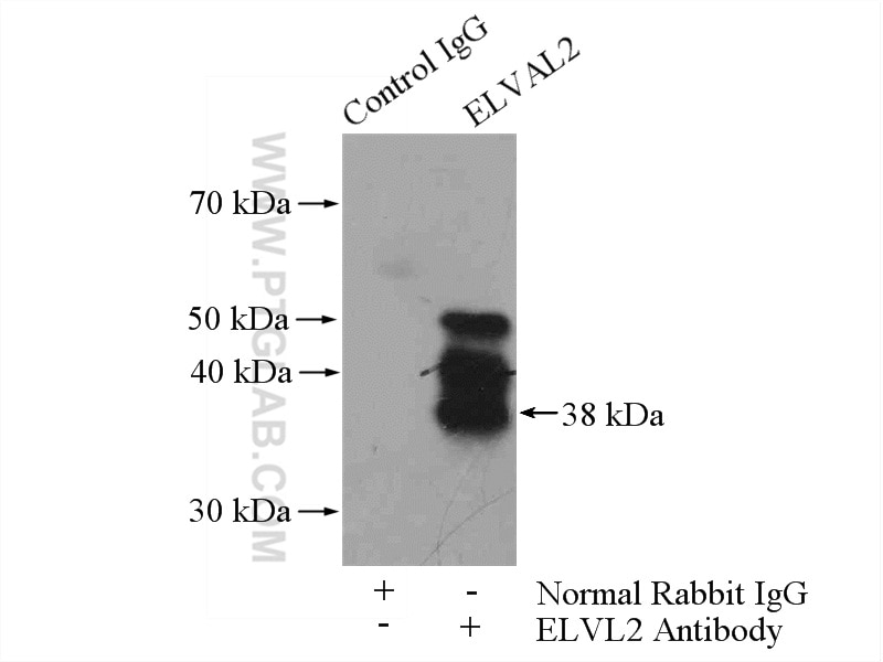 IP experiment of mouse cerebellum using 14008-1-AP