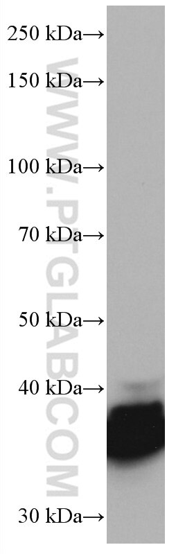 WB analysis of Neuro-2a using 67097-1-Ig