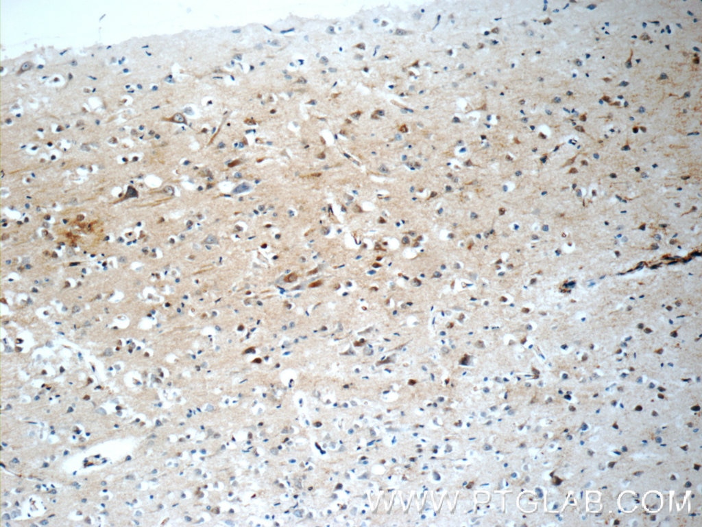 Immunohistochemistry (IHC) staining of human brain tissue using HuC Polyclonal antibody (55047-1-AP)