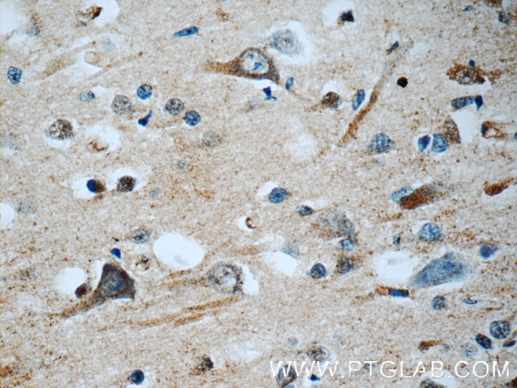 IHC staining of human brain using 55047-1-AP