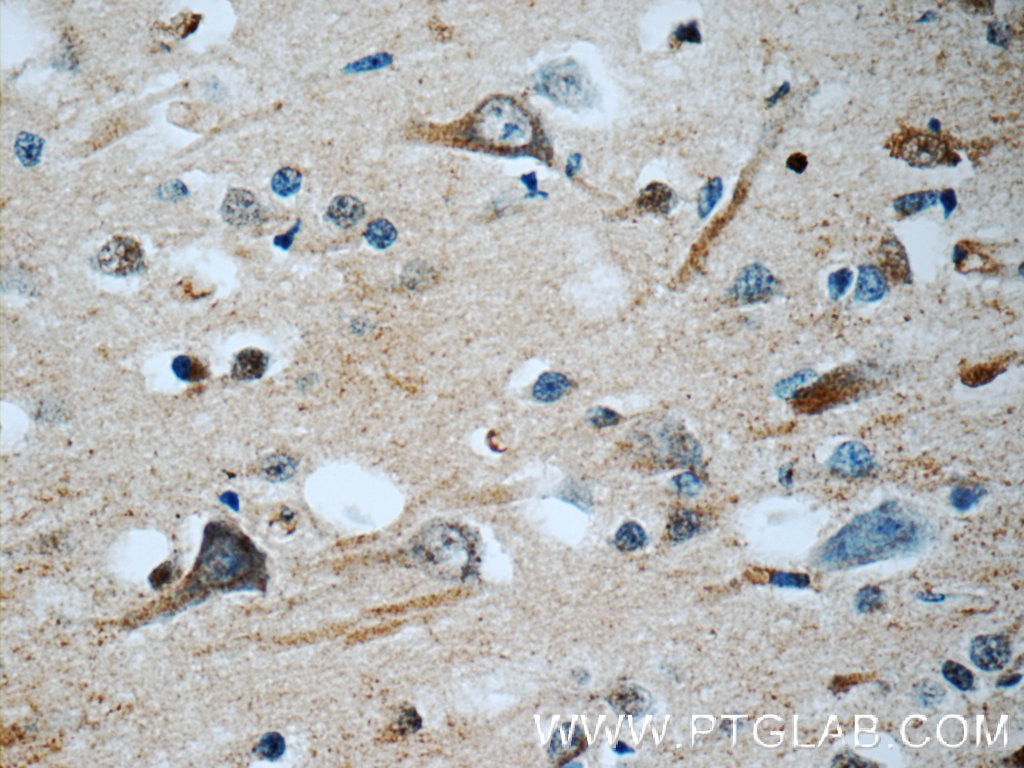 Immunohistochemistry (IHC) staining of human brain tissue using HuC Polyclonal antibody (55047-1-AP)