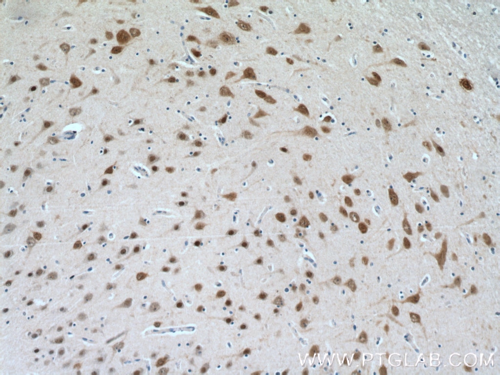 Immunohistochemistry (IHC) staining of human brain tissue using HuA/B/C/D Polyclonal antibody (13032-1-AP)