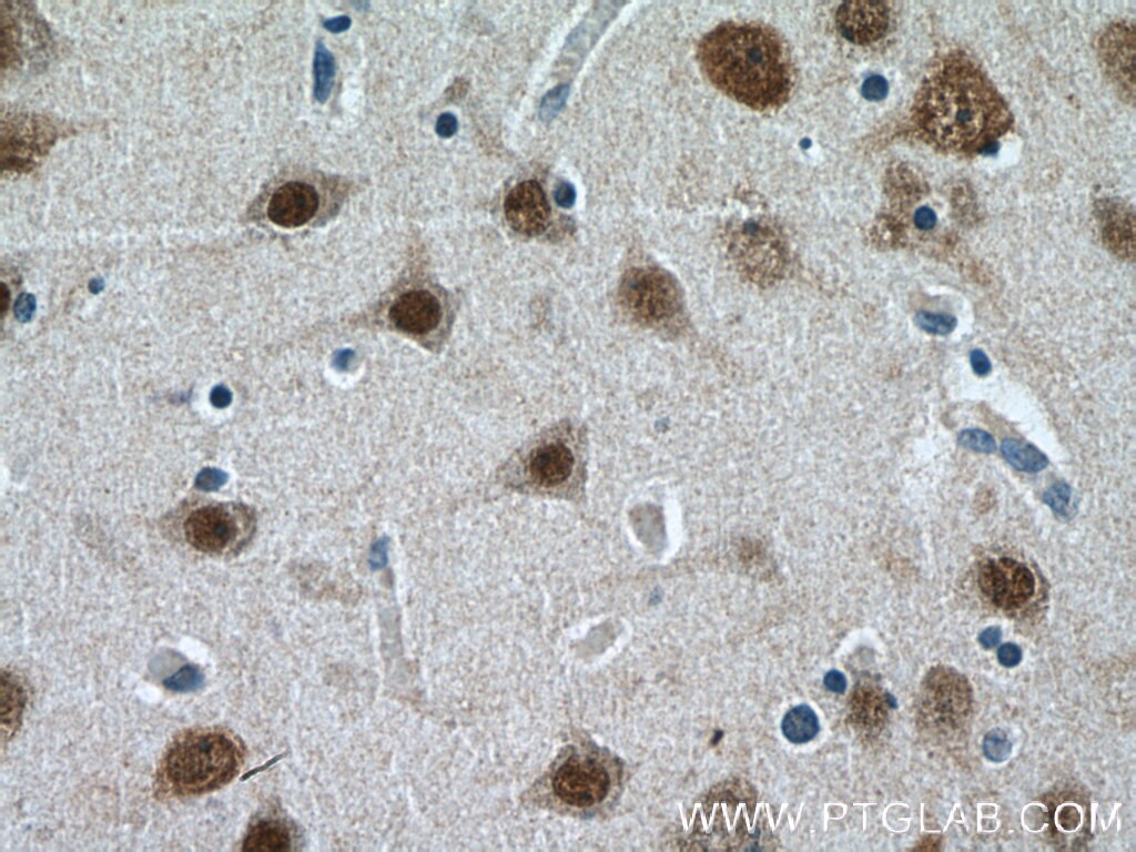 Immunohistochemistry (IHC) staining of human brain tissue using HuA/B/C/D Polyclonal antibody (13032-1-AP)