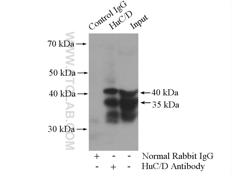 Immunoprecipitation (IP) experiment of mouse brain tissue using HuA/B/C/D Polyclonal antibody (13032-1-AP)