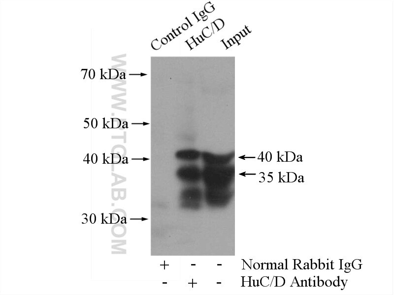 IP experiment of mouse brain using 13032-1-AP