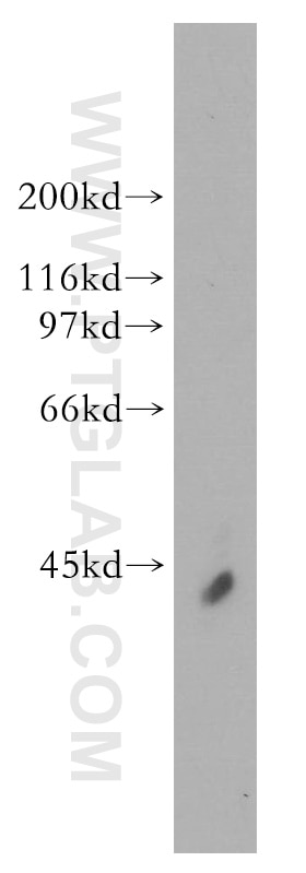 WB analysis of human cerebellum using 13032-1-AP