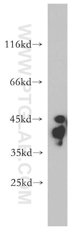 WB analysis of mouse cerebellum using 13032-1-AP