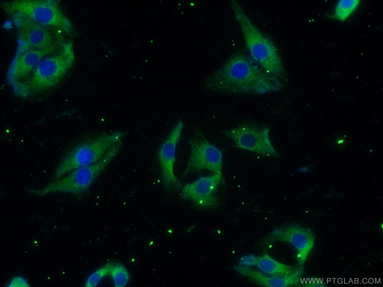 IF Staining of SH-SY5Y using 24992-1-AP