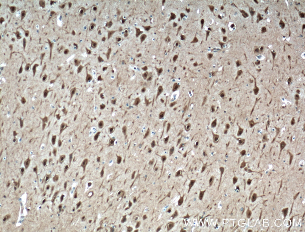 Immunohistochemistry (IHC) staining of human brain tissue using HuD-specific Polyclonal antibody (24992-1-AP)