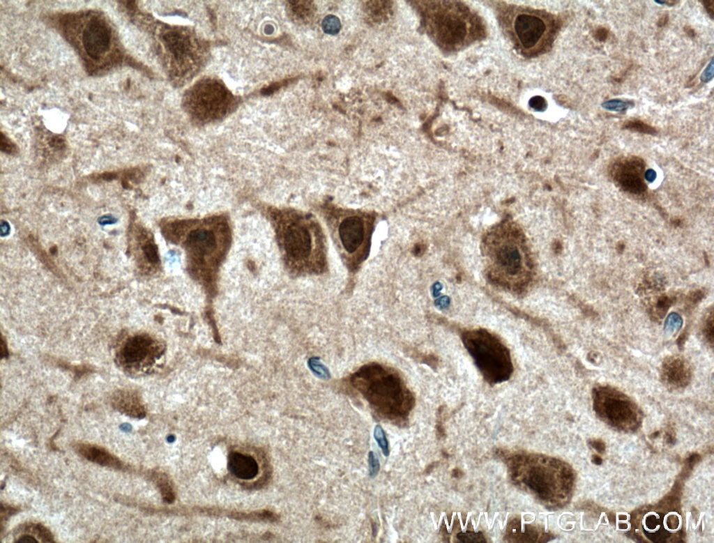 Immunohistochemistry (IHC) staining of human brain tissue using HuD-specific Polyclonal antibody (24992-1-AP)