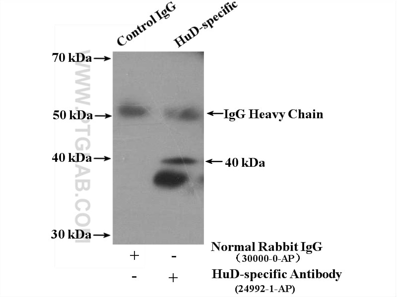 Immunoprecipitation (IP) experiment of mouse brain tissue using HuD-specific Polyclonal antibody (24992-1-AP)