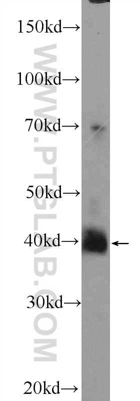 Western Blot (WB) analysis of mouse brain tissue using HuD-specific Polyclonal antibody (24992-1-AP)