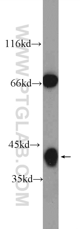 Western Blot (WB) analysis of rat brain tissue using HuD-specific Polyclonal antibody (24992-1-AP)