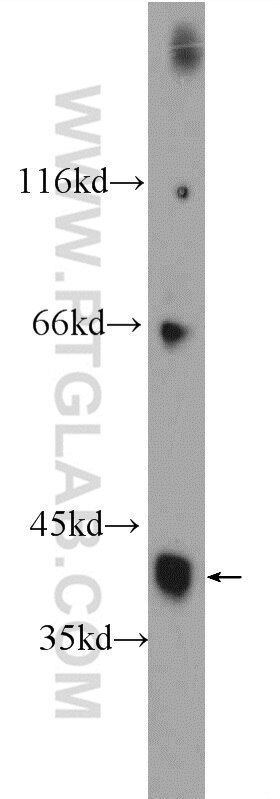 Western Blot (WB) analysis of mouse brain tissue using HuD-specific Polyclonal antibody (24992-1-AP)