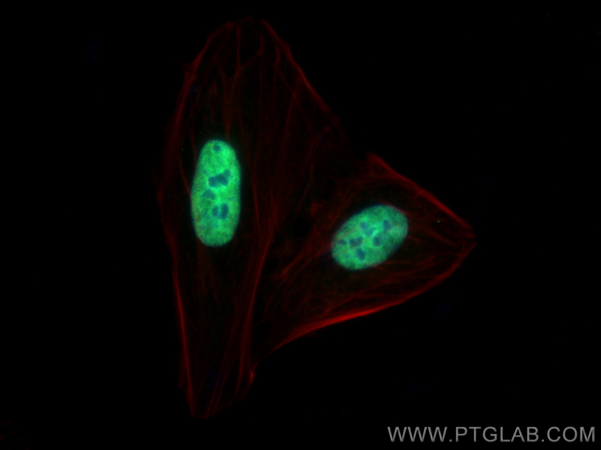 Immunofluorescence (IF) / fluorescent staining of U2OS cells using ELAVL4 Monoclonal antibody (67835-1-Ig)