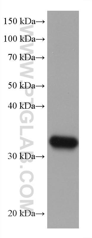 WB analysis of U2OS using 67835-1-Ig