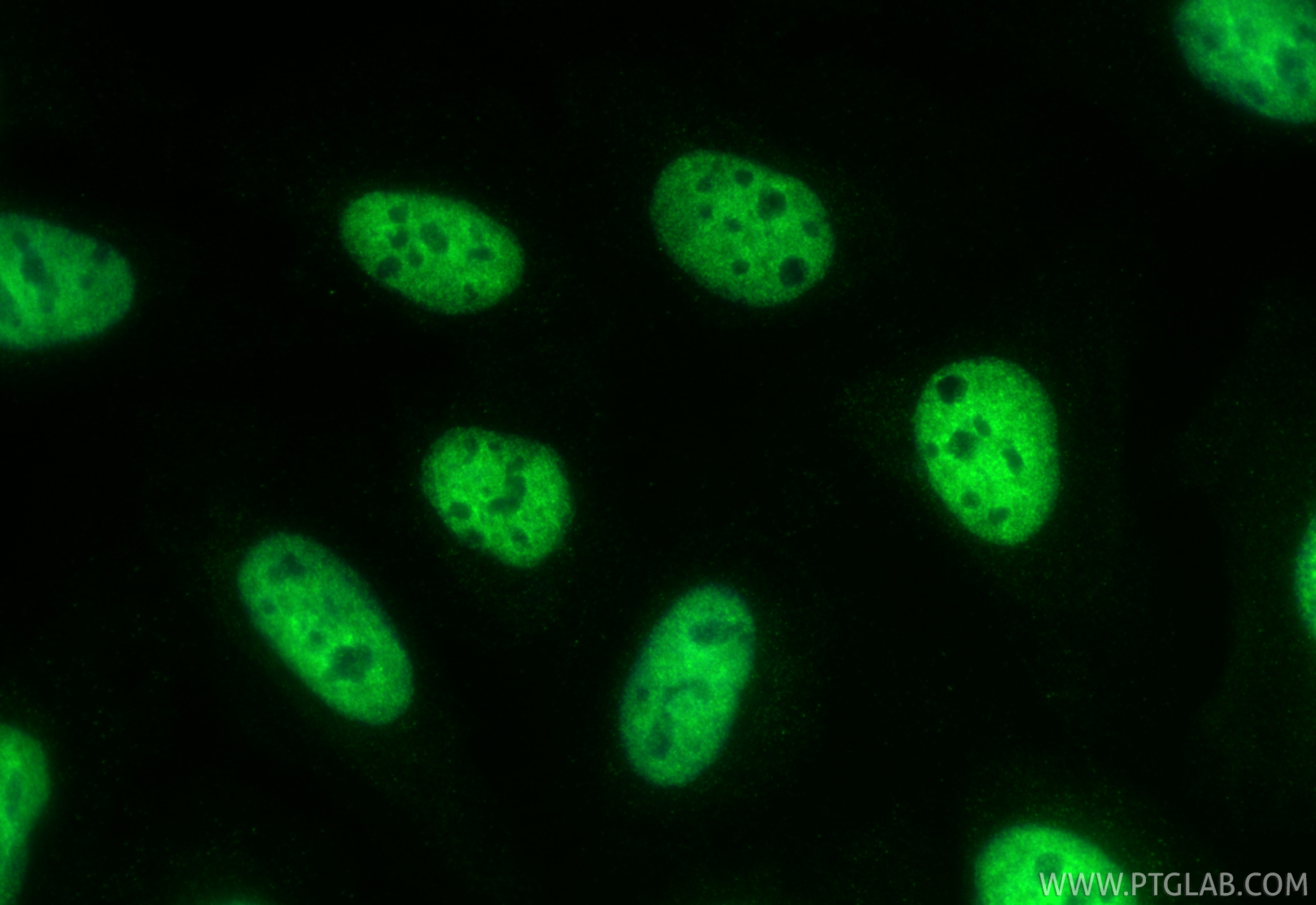 IF Staining of U2OS using CL488-67835 Immunofluorescence (IF) / fluorescent staining of U2OS cells using CoraLite® Plus 488-conjugated ELAVL4 Monoclonal an (CL488-67835)