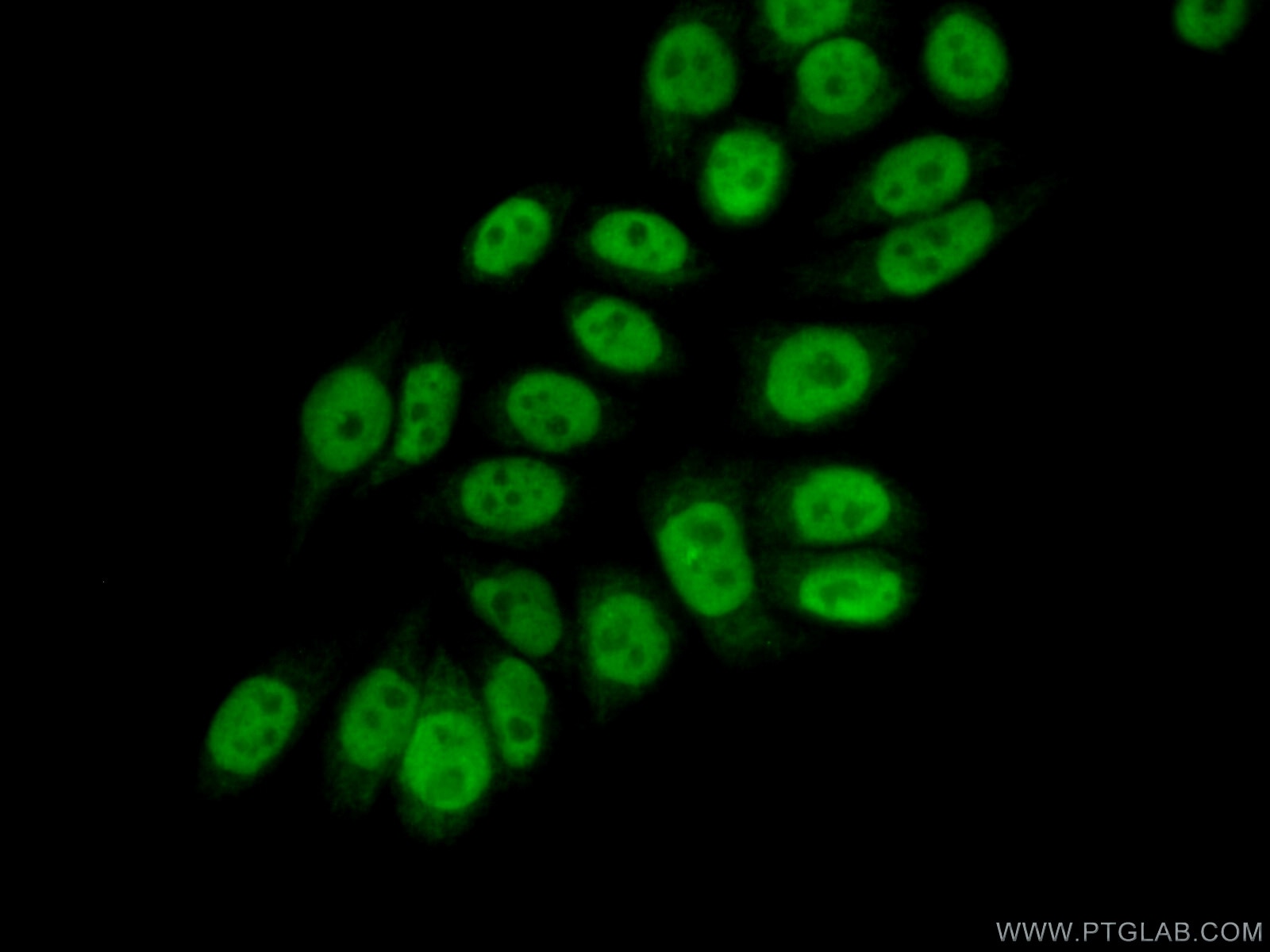 Immunofluorescence (IF) / fluorescent staining of PC-3 cells using ELF1 Polyclonal antibody (22565-1-AP)