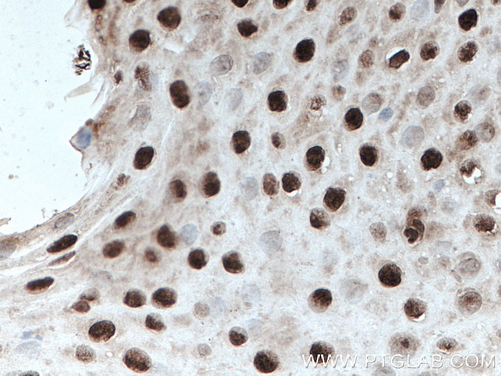 Immunohistochemistry (IHC) staining of human tonsillitis tissue using ELF1 Polyclonal antibody (22565-1-AP)