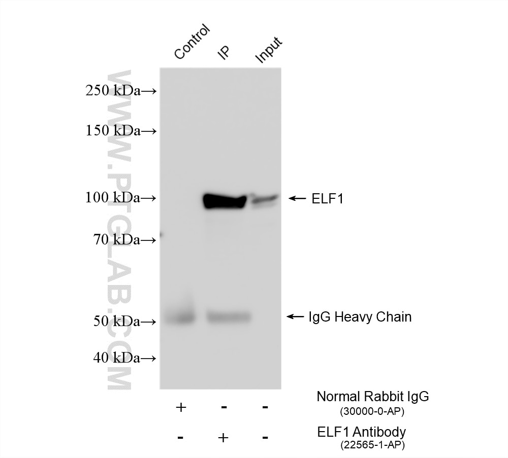 IP result of anti-ELF1 (IP:22565-1-AP, 4ug; Detection:22565-1-AP 1:5000) with THP-1 cells lysate 1800 ug. Immunoprecipitation (IP) experiment of THP-1 cells using ELF1 Polyclonal antibody (22565-1-AP)