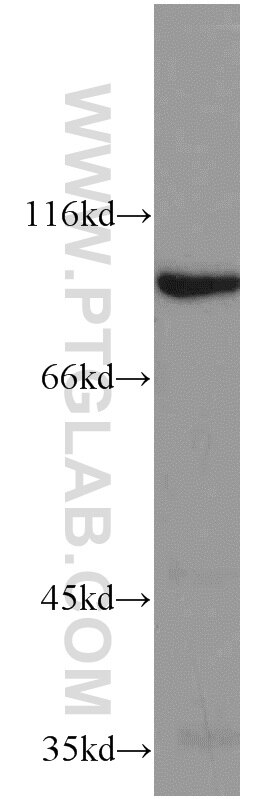Western Blot (WB) analysis of HeLa cells using ELF1 Polyclonal antibody (22565-1-AP)