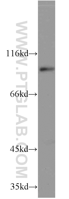 Western Blot (WB) analysis of A431 cells using ELF1 Polyclonal antibody (22565-1-AP)