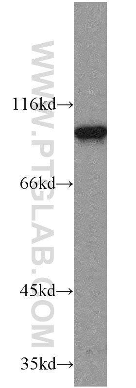 Western Blot (WB) analysis of Jurkat cells using ELF1 Polyclonal antibody (22565-1-AP)