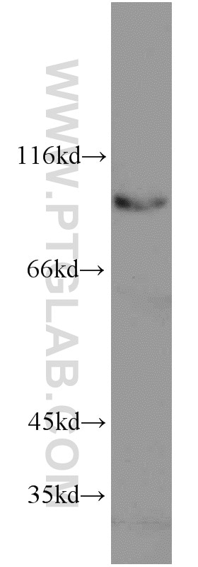Western Blot (WB) analysis of mouse thymus tissue using ELF1 Polyclonal antibody (22565-1-AP)
