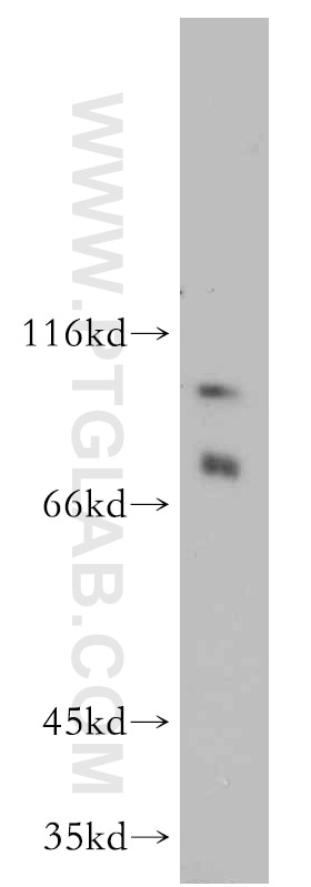 Western Blot (WB) analysis of Jurkat cells using ELF1 Polyclonal antibody (55029-1-AP)