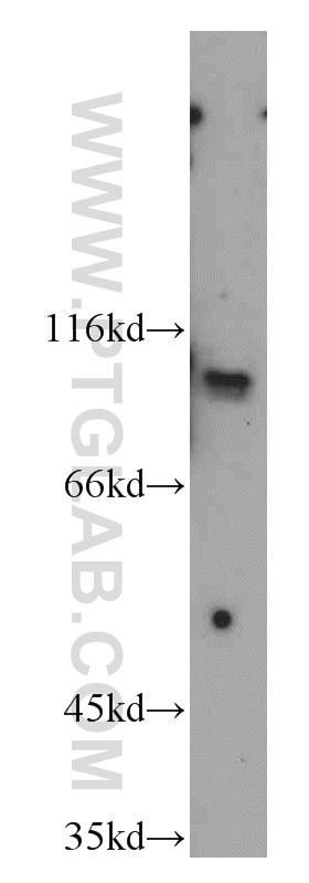 WB analysis of Jurkat using 55029-1-AP