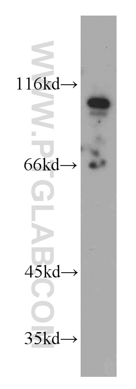 Western Blot (WB) analysis of A431 cells using ELF1 Polyclonal antibody (55029-1-AP)