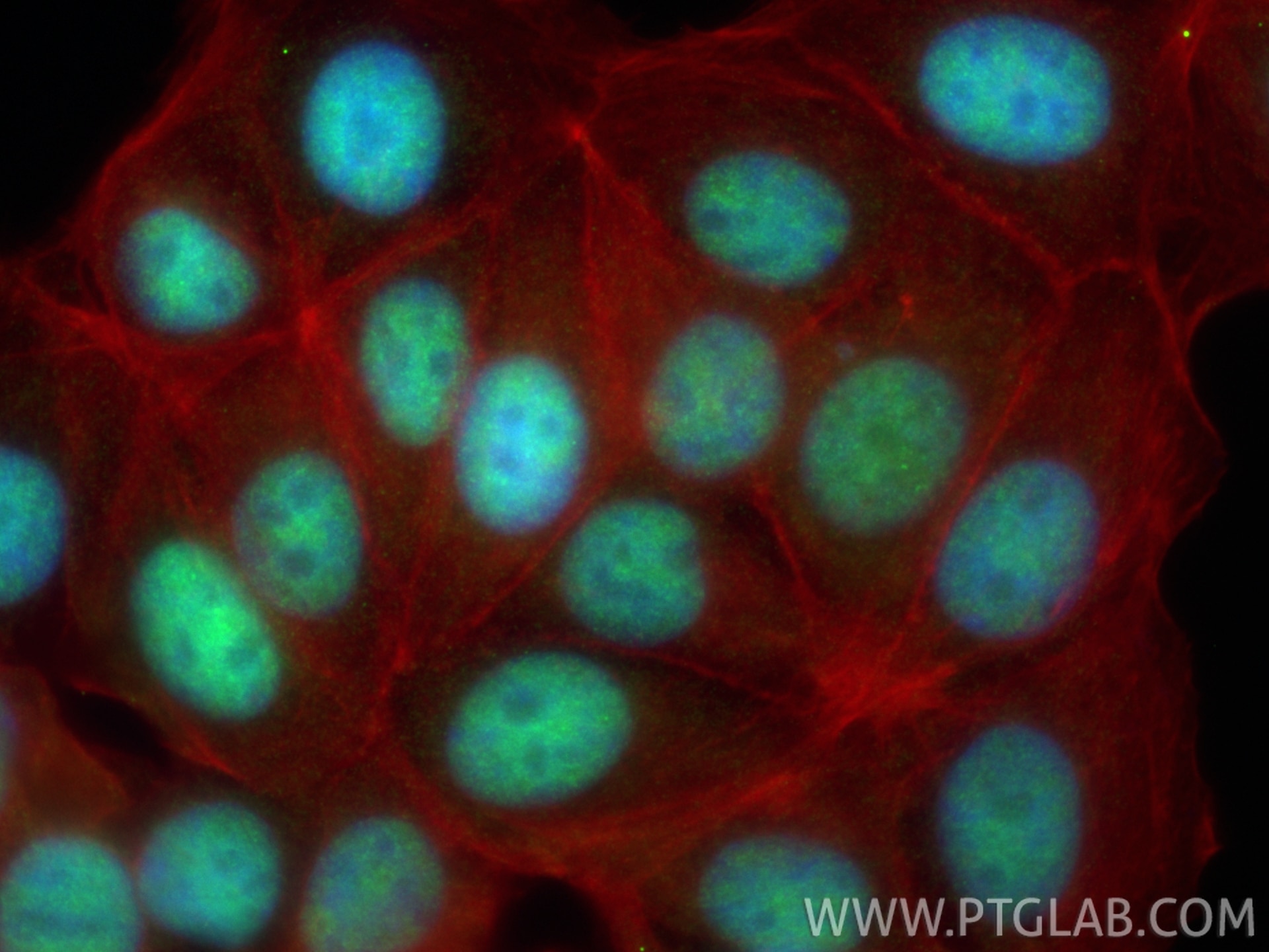 IF Staining of MCF-7 using 12499-1-AP Immunofluorescence (IF) / fluorescent staining of MCF-7 cells using ELF2 Polyclonal antibody (12499-1-AP)