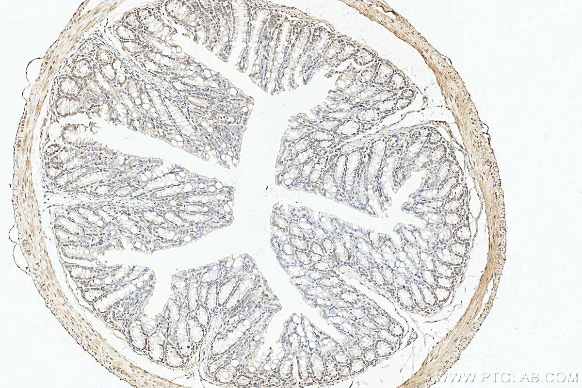 Immunohistochemistry (IHC) staining of mouse colon tissue using ELF2 Polyclonal antibody (12499-1-AP)