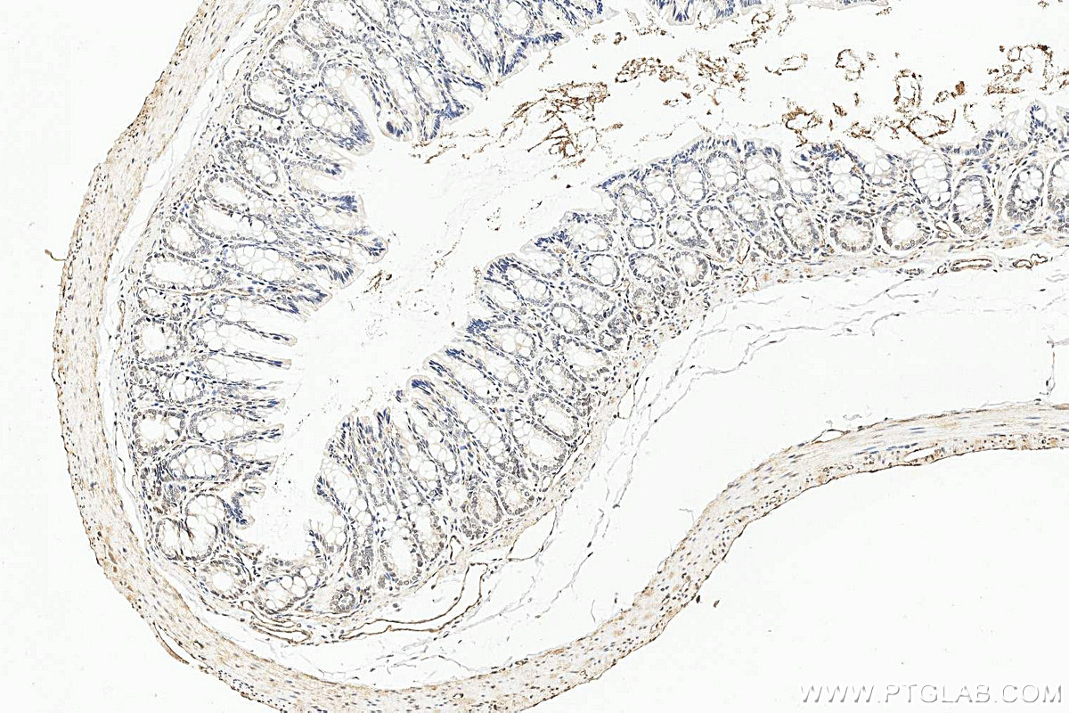 Immunohistochemistry (IHC) staining of rat colon tissue using ELF2 Polyclonal antibody (12499-1-AP)