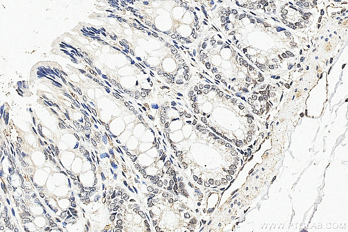 Immunohistochemistry (IHC) staining of rat colon tissue using ELF2 Polyclonal antibody (12499-1-AP)