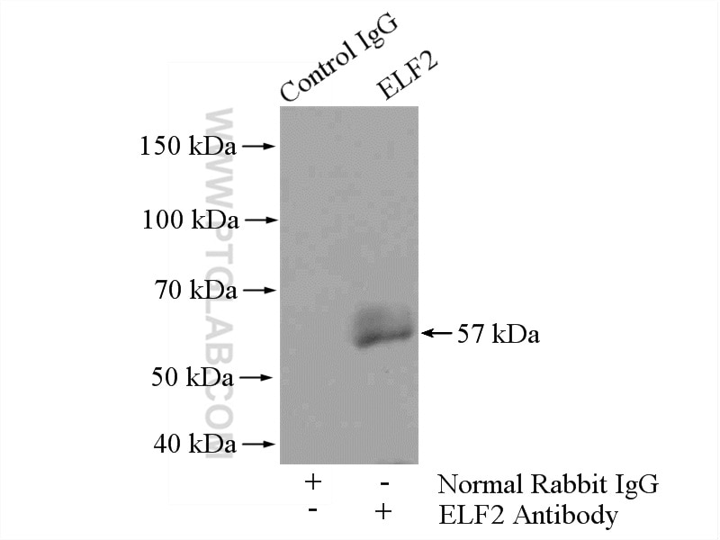 Immunoprecipitation (IP) experiment of A2780 cells using ELF2 Polyclonal antibody (12499-1-AP)