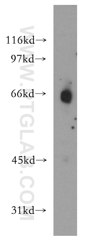 Western Blot (WB) analysis of human brain tissue using ELF2 Polyclonal antibody (12499-1-AP)