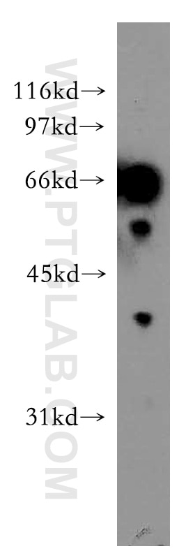Western Blot (WB) analysis of human liver tissue using ELF2 Polyclonal antibody (12499-1-AP)