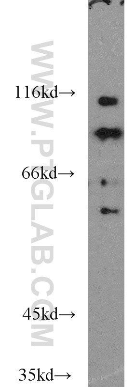 WB analysis of PC-3 using 16020-1-AP