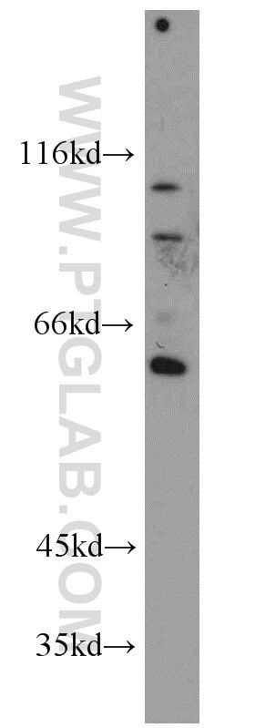 Western Blot (WB) analysis of Jurkat cells using ELF4 Polyclonal antibody (16020-1-AP)