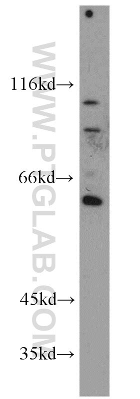 WB analysis of Jurkat using 16020-1-AP