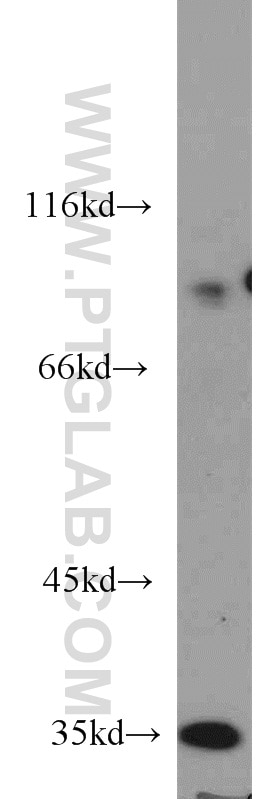 Western Blot (WB) analysis of mouse spleen tissue using ELF4 Polyclonal antibody (16020-1-AP)