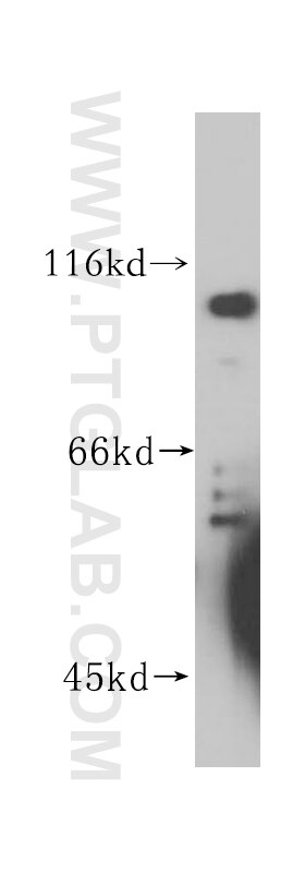 WB analysis of HeLa using 16020-1-AP