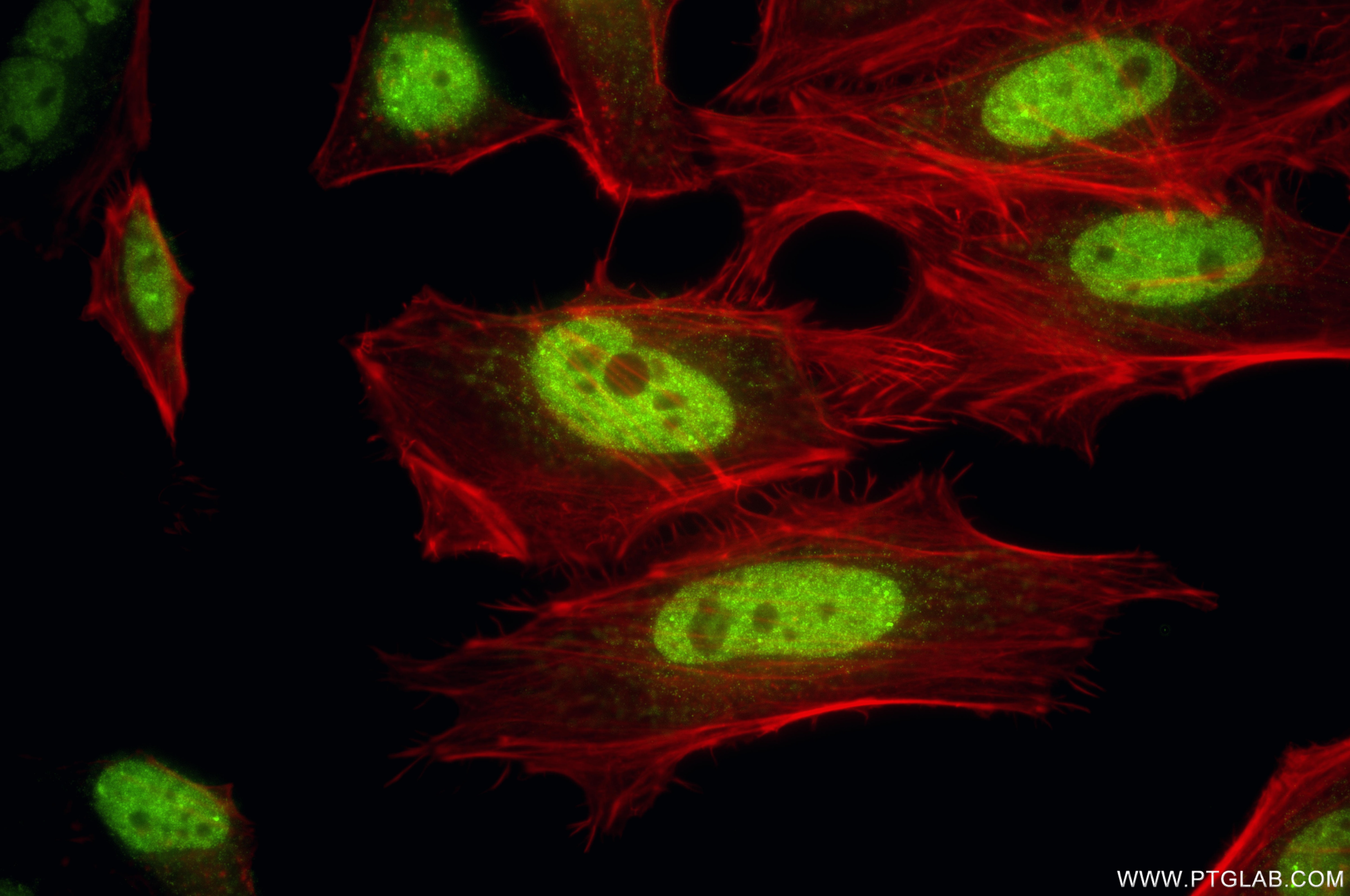 Immunofluorescence (IF) / fluorescent staining of HeLa cells using ELK1 Recombinant monoclonal antibody (87009-2-RR)