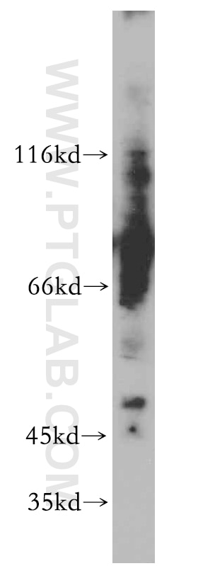 Western Blot (WB) analysis of MCF-7 cells using ELK4 Polyclonal antibody (14666-1-AP)