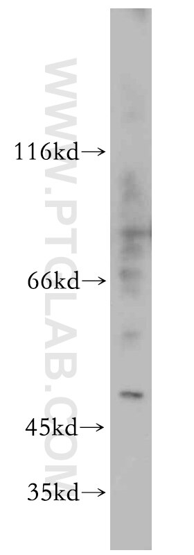 Western Blot (WB) analysis of MCF-7 cells using ELK4 Polyclonal antibody (14666-1-AP)