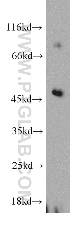 Western Blot (WB) analysis of mouse liver tissue using ELK4 Polyclonal antibody (14666-1-AP)