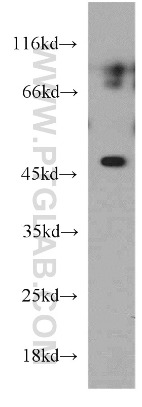 Western Blot (WB) analysis of Jurkat cells using ELK4 Polyclonal antibody (14666-1-AP)
